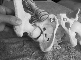 股関節痛　変形性股関節症　臼蓋形成不全　ストラップモビリゼーション（ストラップけん引法）